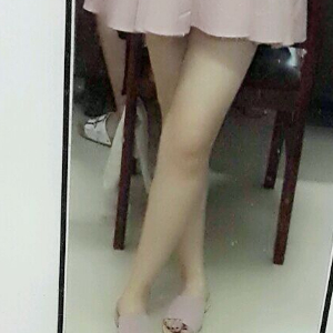 看看我大腿吸脂的恢復果圖片吧，是東方和諧王自謙做的